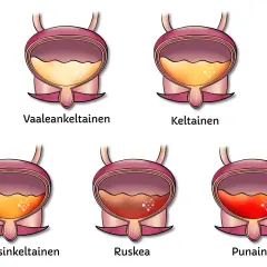 Illustrationer visar urinblåsor med olika färger, från ljusgult till rött. Det röda visar blod i urinen, som om en hund kissar blod.
