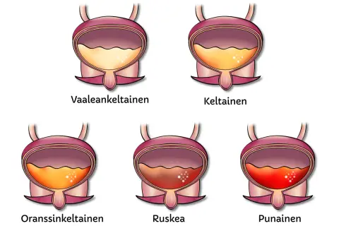 Illustrationer visar urinblåsor med olika färger, från ljusgult till rött. Det röda visar blod i urinen, som om en hund kissar blod.