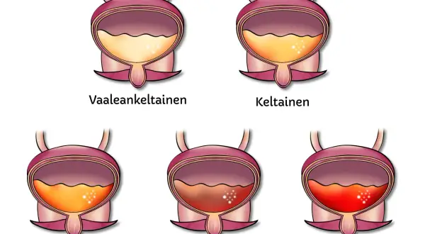 Illustrationer visar urinblåsor med olika färger, från ljusgult till rött. Det röda visar blod i urinen, som om en hund kissar blod.