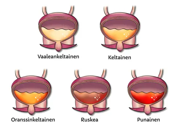 Illustrationer visar urinblåsor med olika färger, från ljusgult till rött. Det röda visar blod i urinen, som om en hund kissar blod.