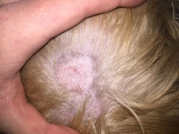 Närbild på hundens hud med en fläck som kan behöva ringorm behandling. Huden är röd och lite fjällande.
